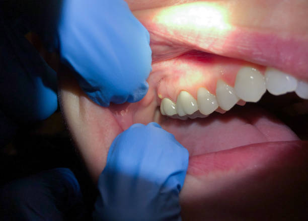 Best Urgent Dental Care for Toothaches in Meadowlakes, TX